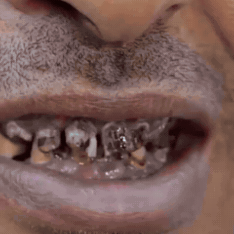 Espuma Blanqueadora Dental VOQUE