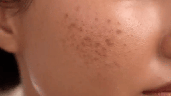 Jabón de Cúrcuma Glo Melanin: iDespierta tu piel radiante sin manchas!
