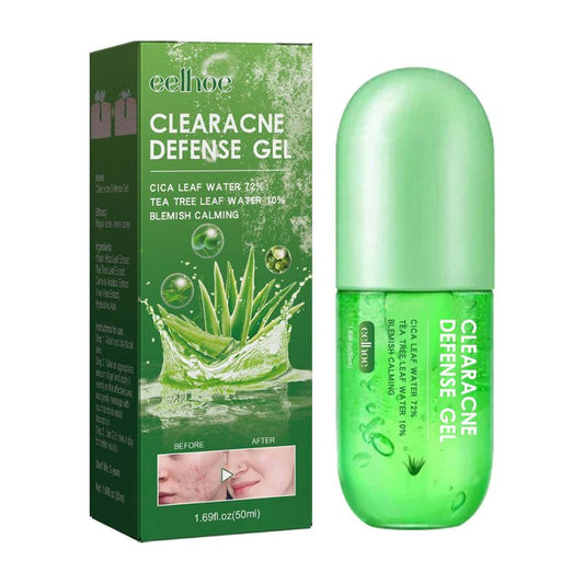 Gel anti acné: dile adiós a las imperfecciones